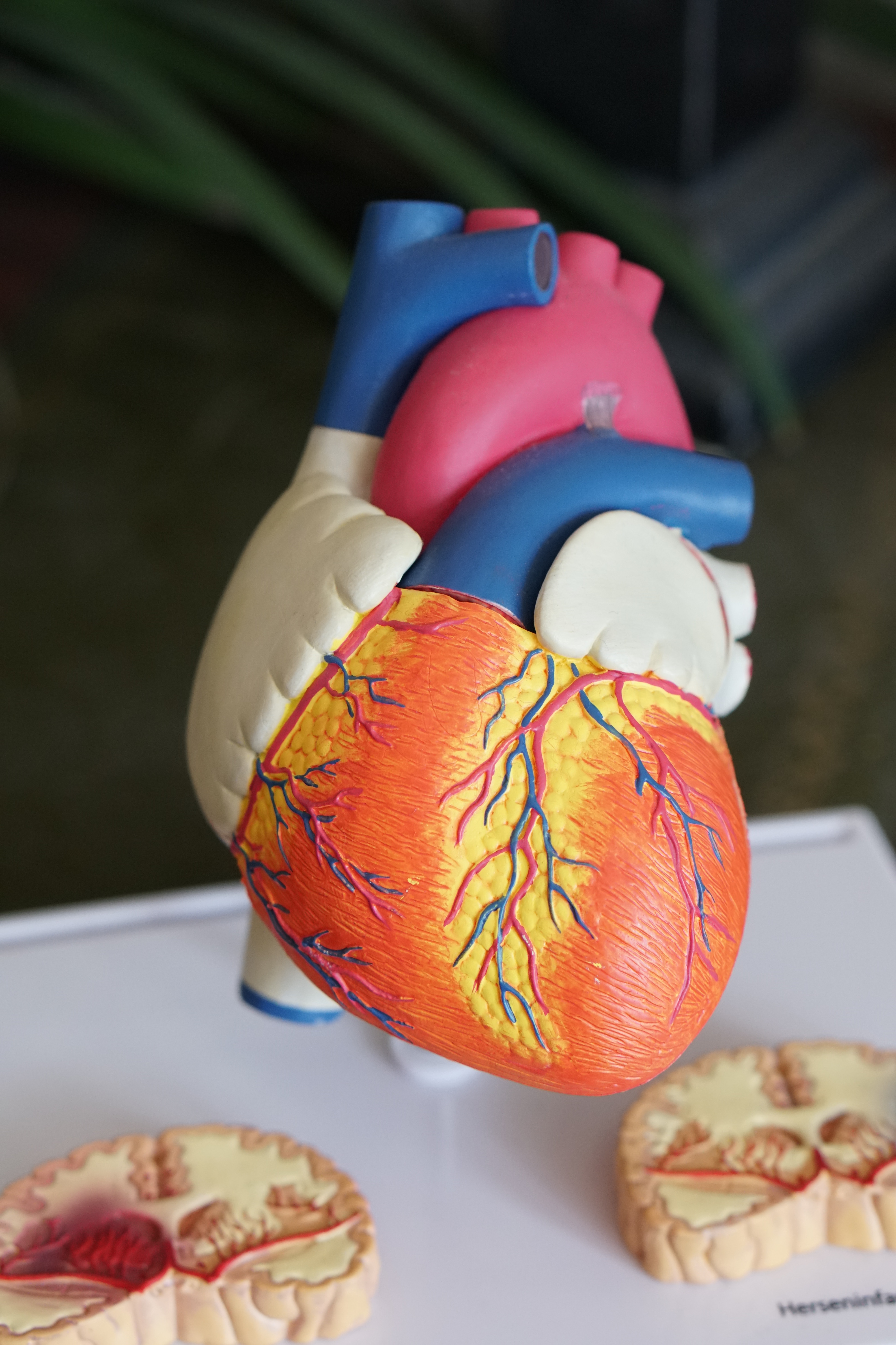 Sudden Cardiac Arrest and What You Should Know about it